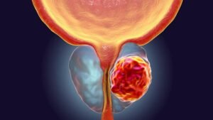 img_efreire_20190519-205401_imagenes_lv_terceros_cancer_de_prostata-k3CC-U462339358041CeC-992x558@LaVanguardia-Web