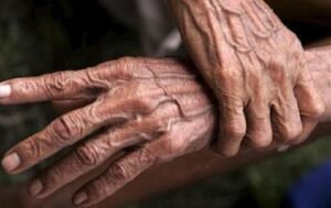 Anciana-de-96-años-murió-por-Covid-19-en-Santa-Marta