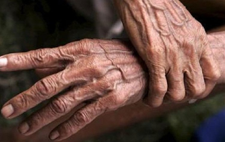 Anciana-de-96-años-murió-por-Covid-19-en-Santa-Marta